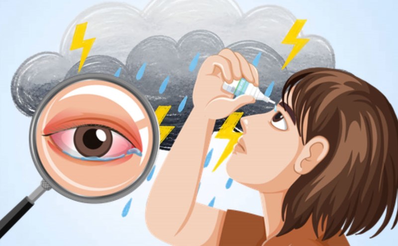 Simple solutions for dry eyes in the wet rainy season. Graphics: Thien Nhan