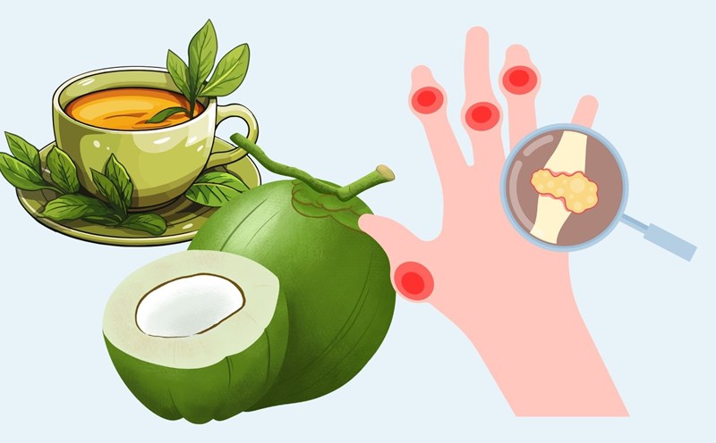Not only lemon juice, these drinks also help reduce uric acid effectively. Graphics: Linh Dan