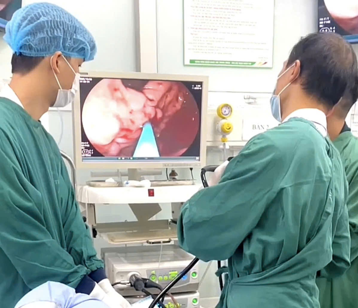 의사들이 검은색 변을 보고 병원에 와서야 소화기 출혈이 있다는 것을 알게 된 남성을 응급 처치하고 있습니다. 사진: Thanh Dang