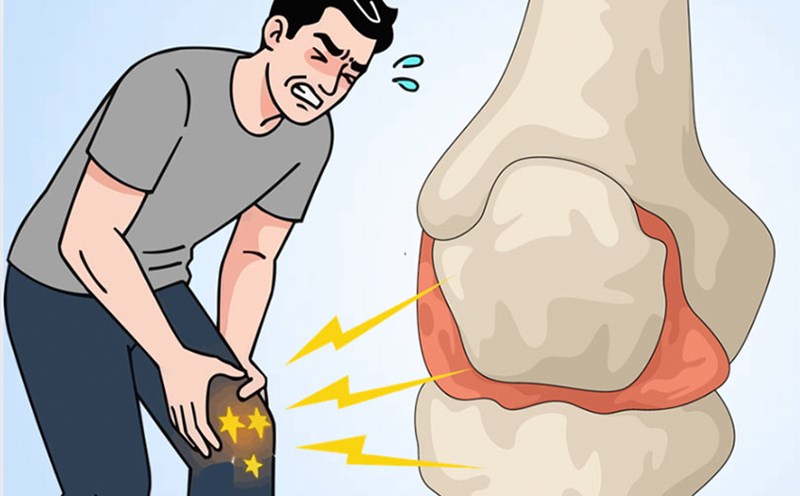 Early signs of arthritis are often overlooked by young people. Graphics: Thien Nhan