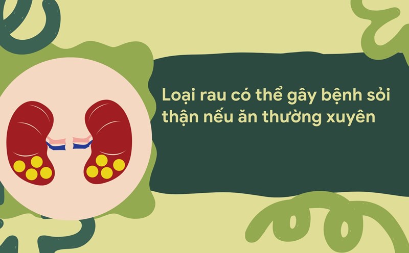 Spinach has a lot of oxalate combined with calcium to create insoluble crystals, which accumulate over time and easily form kidney stones. Graphic photo: Huong Son