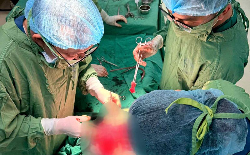 Doctors at the Central Obstetrics and Gynecology Hospital raced for 3 hours to save the mother and child. Photo: BVCC