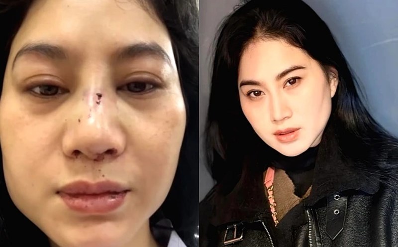 Actriz Phi Ngoc Anh. Foto: Personaje proporcionada.