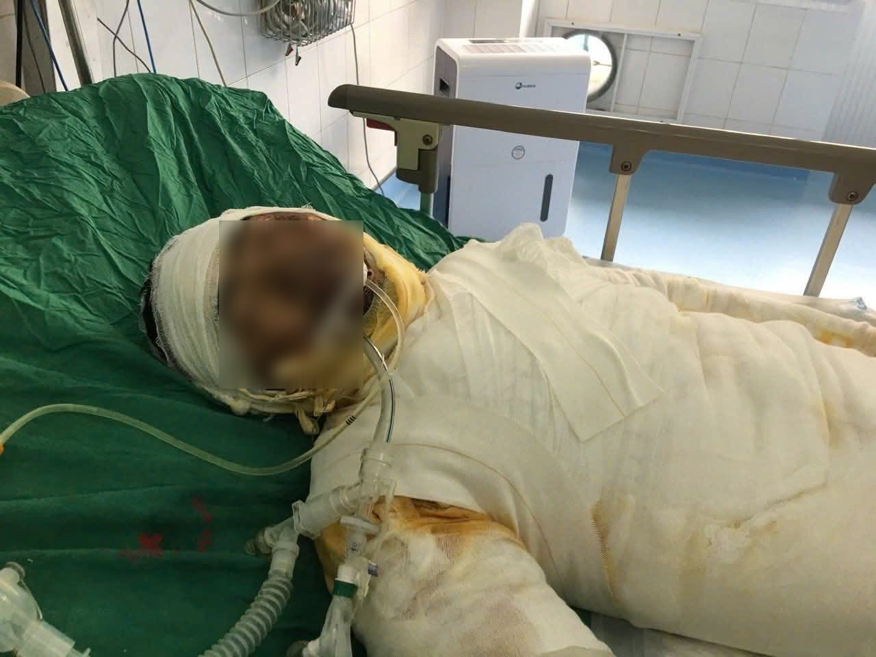 Hai Phong의 Tu Ky 출신의 순한 소년이 병상에서 의사와 간호사의 집중 치료를 받고 있습니다. 사진: 가족 제공