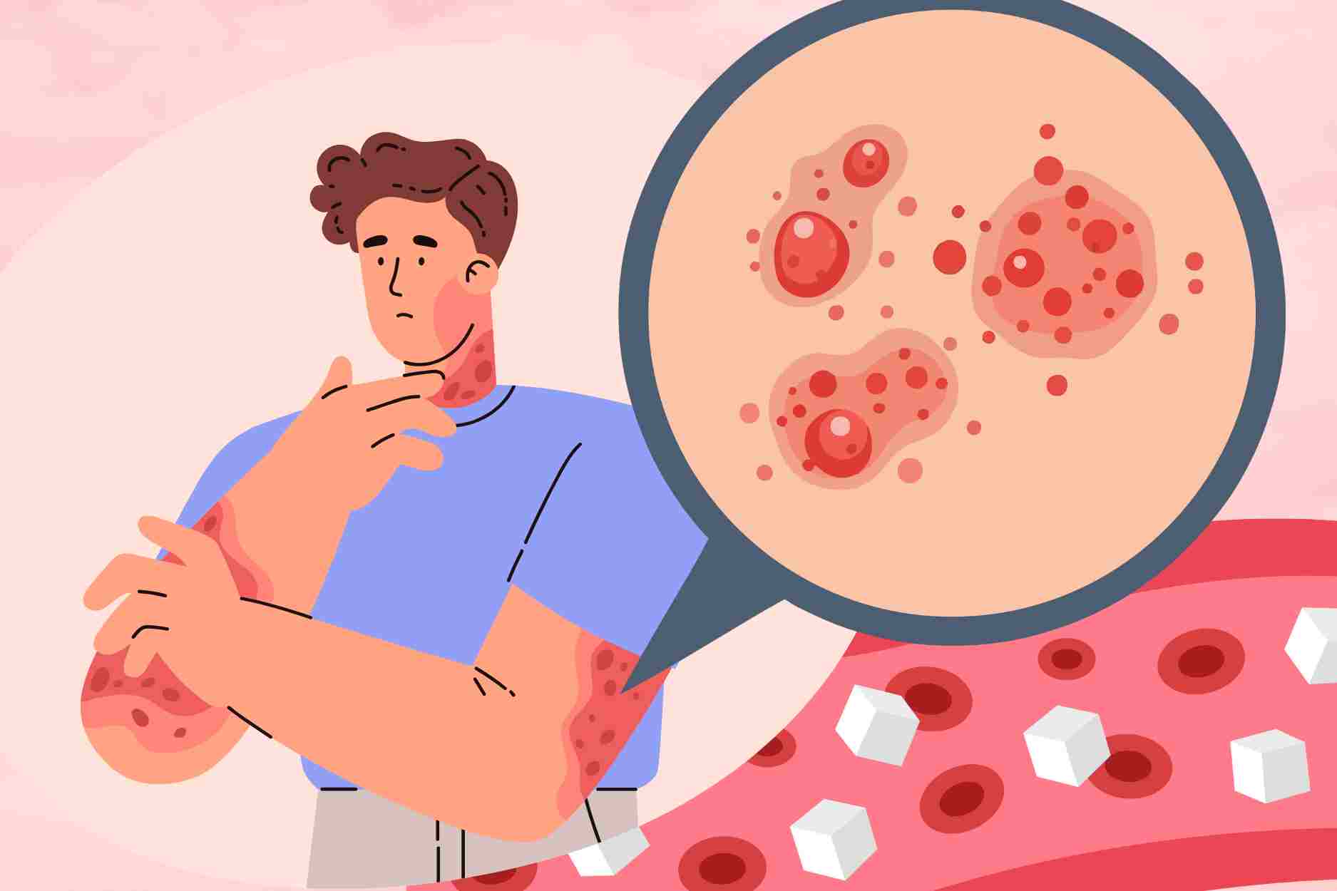 Tips to effectively reduce itchy skin for people with diabetes