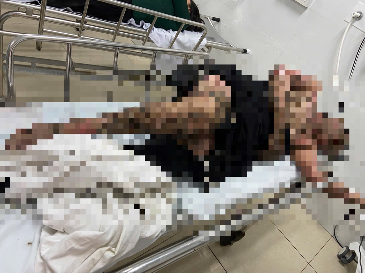 Nguoi dan ong bi dien giat khi cau ca, duoc dua di cap cuu. Anh: Duy Tuan 