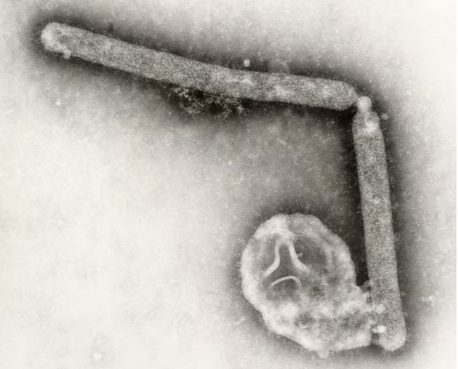 The largest avian influenza virus ever recorded in humans has been recorded in the US for the first time in 9 months. Photo: CDC USA