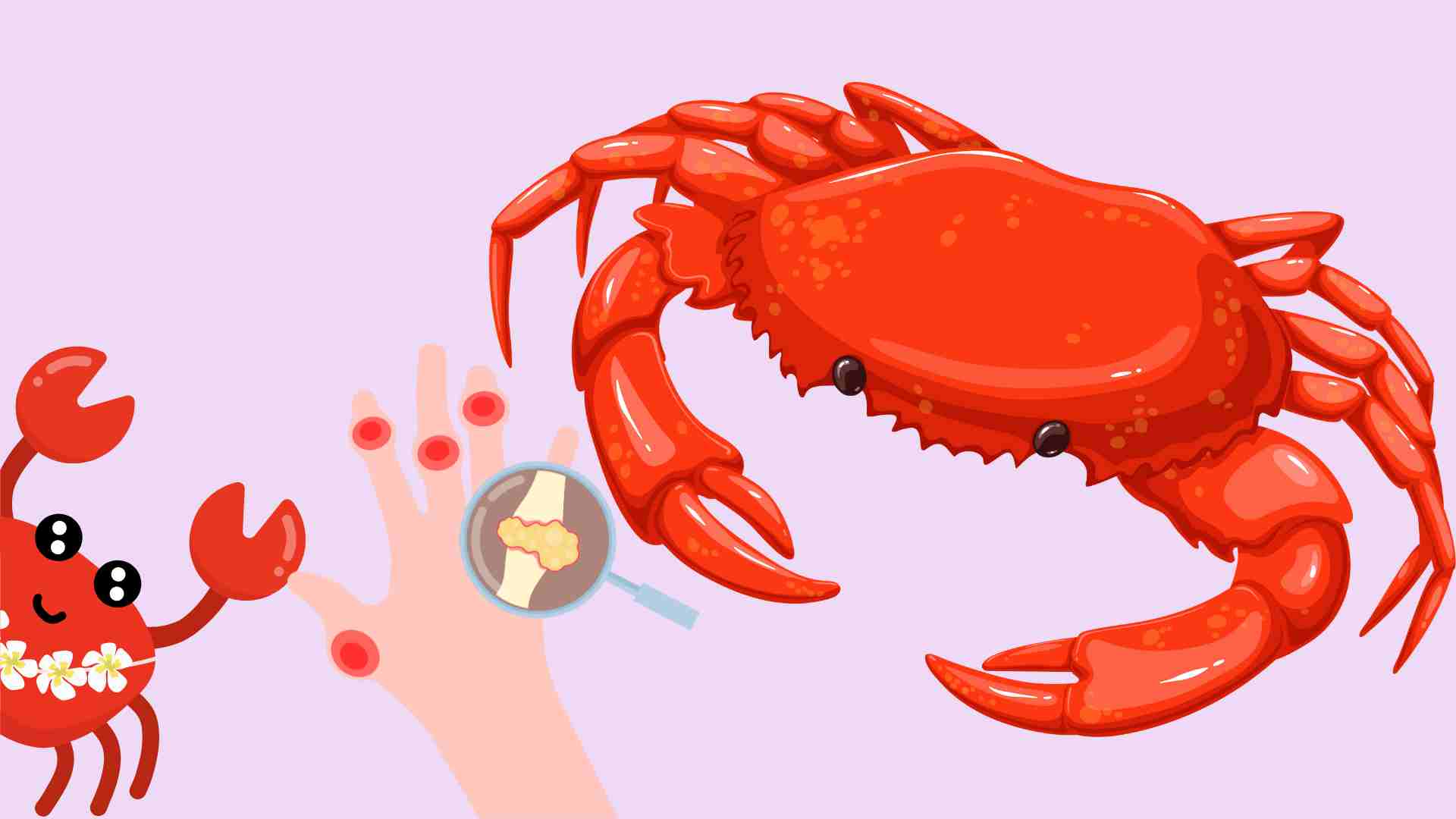 People with high uric acid should eat crab properly to be good for their health. Graphics: Ha May
