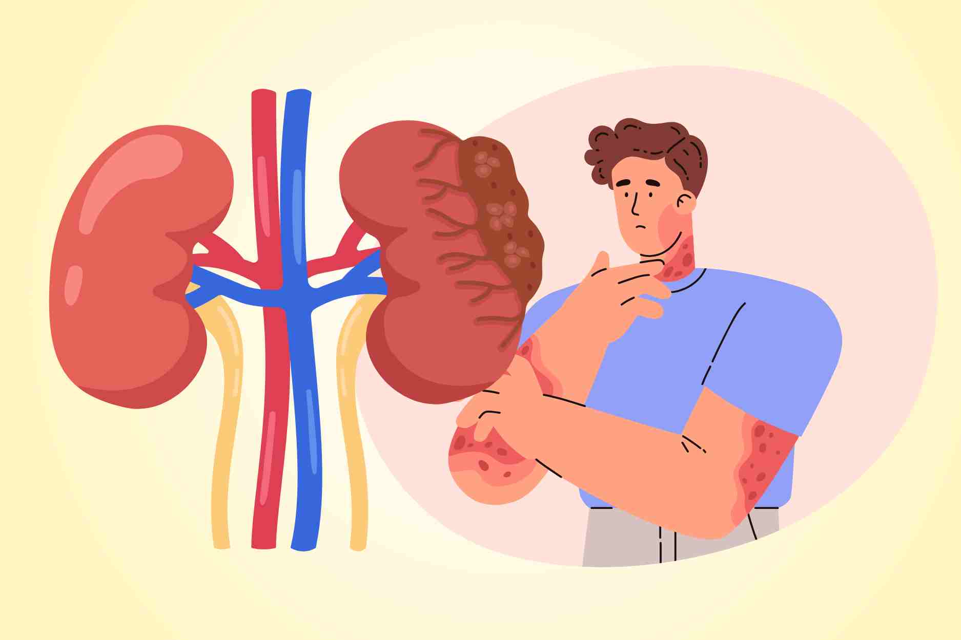 Persistent itching in these locations can warn of poor kidneys