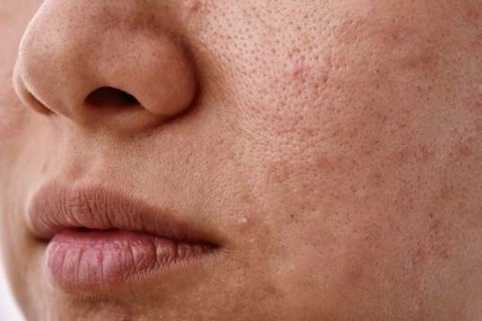 Three foods rich in vitamins and antioxidants can help skin become firmer, smoother and more youthful from within. Photo: Huong Son