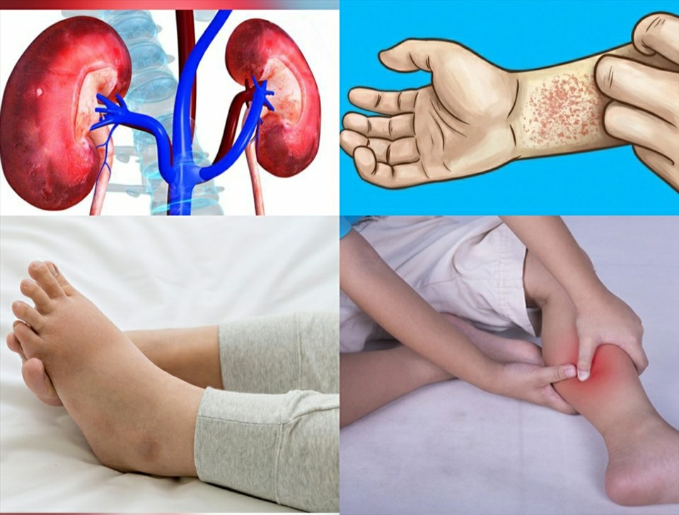 Signs that your kidneys have problems. Graphics: Bach Cuc