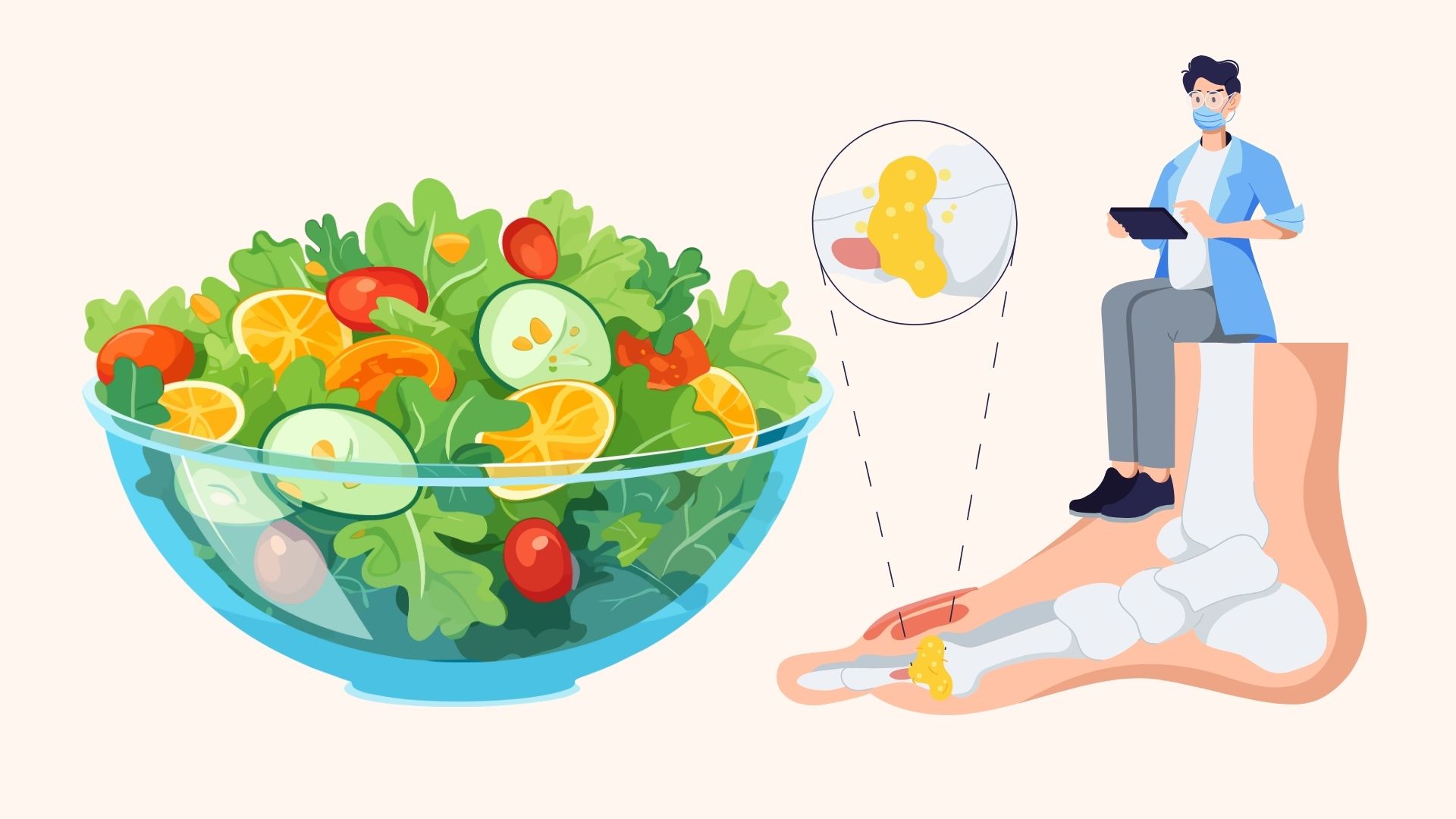 Uric acid increases in cold weather, how to relieve joint pain at home. Graphics: Linh Dan