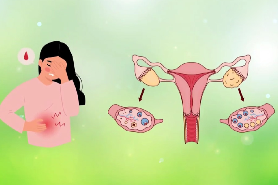 3 types of food that effectively increase female hormones