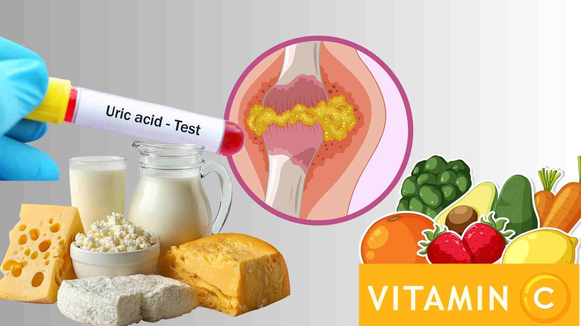 요산 전환에 도움이 될 수 있는 몇 가지 식품을 보충하십시오. 그래픽: 하 메이