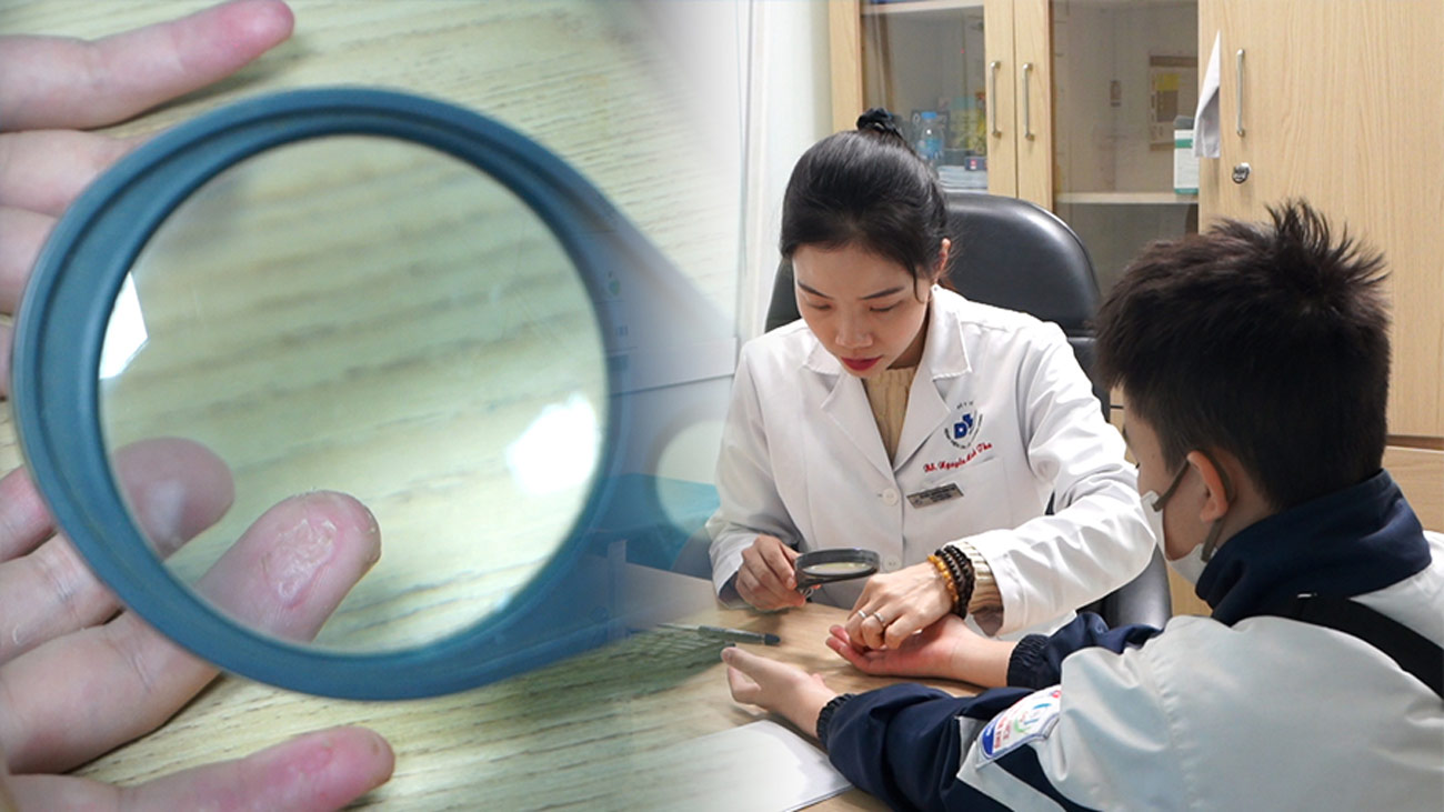 Cold, dry weather, doctors warn of the cause of increased dryness and itching