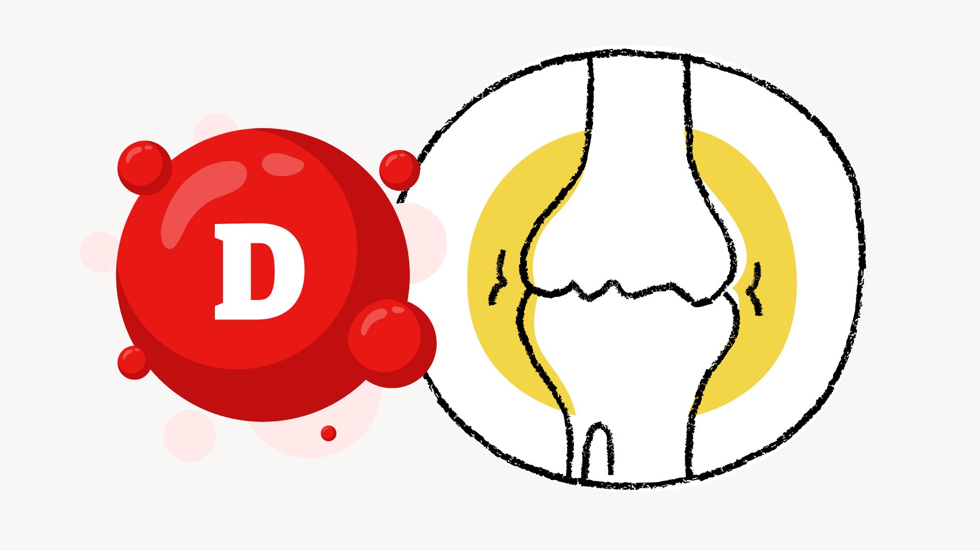 When the body lacks vitamin D, the ability to absorb calcium decreases, causing bones to gradually lose density, becoming weak and prone to fracture. Graphics: Thanh Thanh