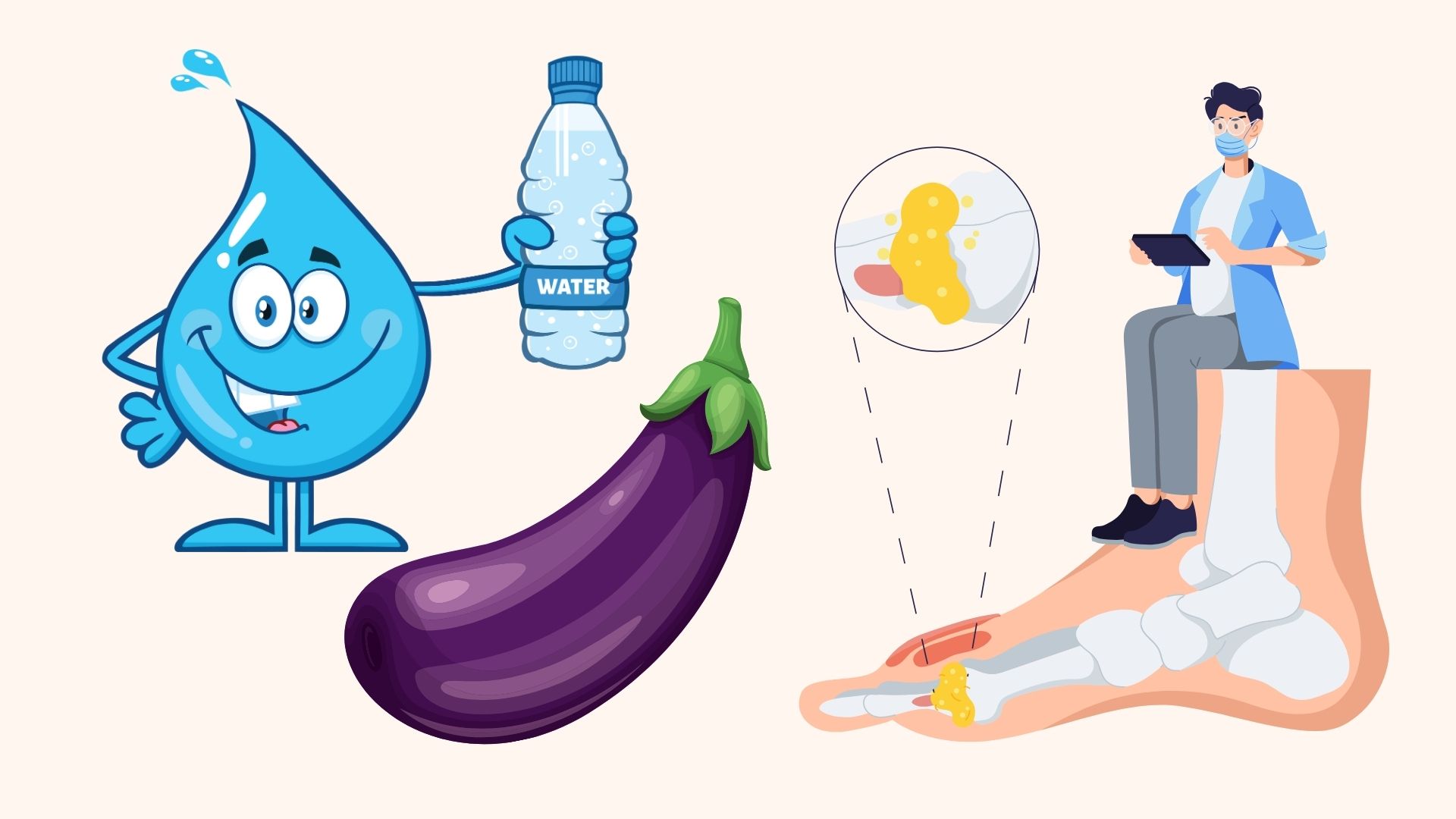 고요산혈증 환자를 위한 식품 제안. 그래픽: 린단