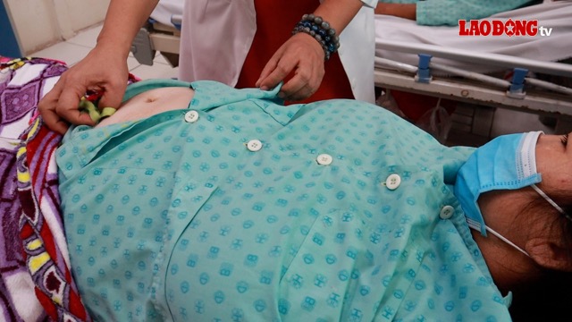 Persistent swelling is one of the most obvious manifestations of kidney failure. Photo: Nguyen Ly