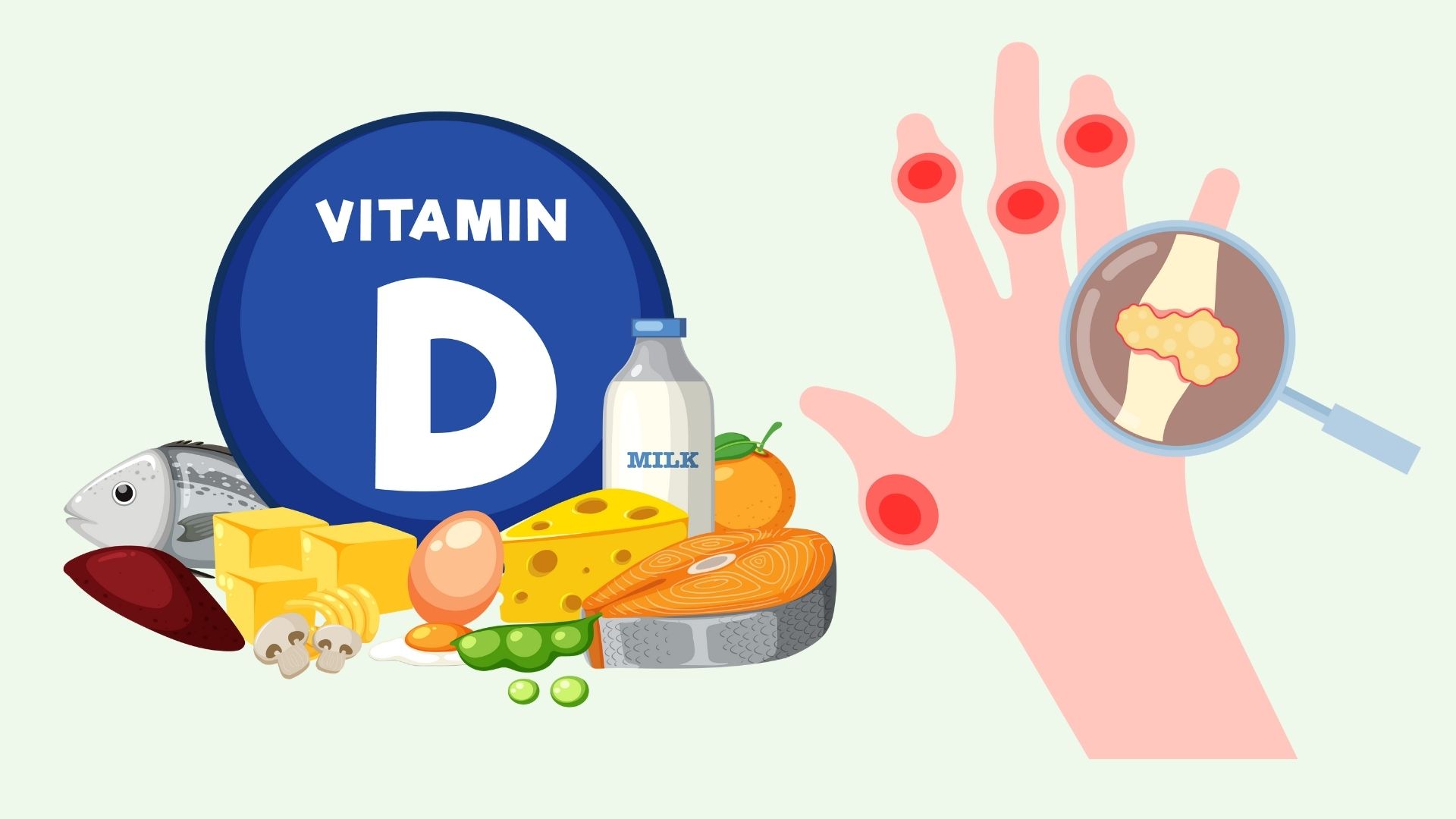 Low vitamin D, uric acid silently increases. Graphics: Linh Dan