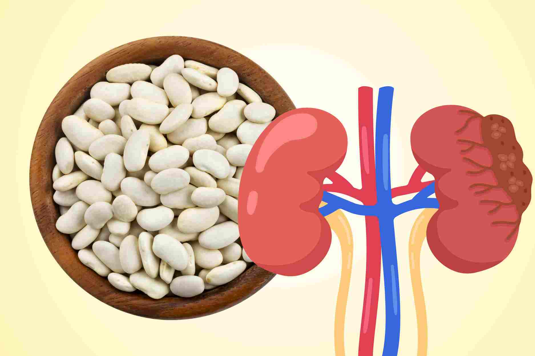 Important notes when using white beans for kidney patients