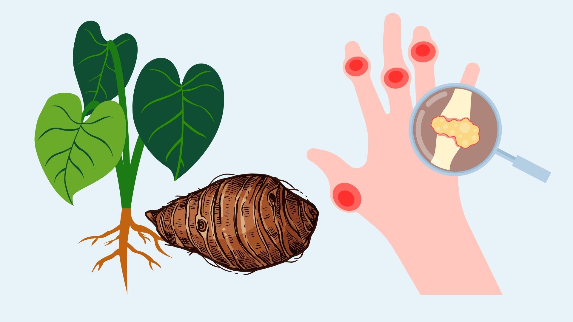Un tipo de raiz popular facil de encontrar que ayuda a reducir el acido urico. Grafico: Linh Dan