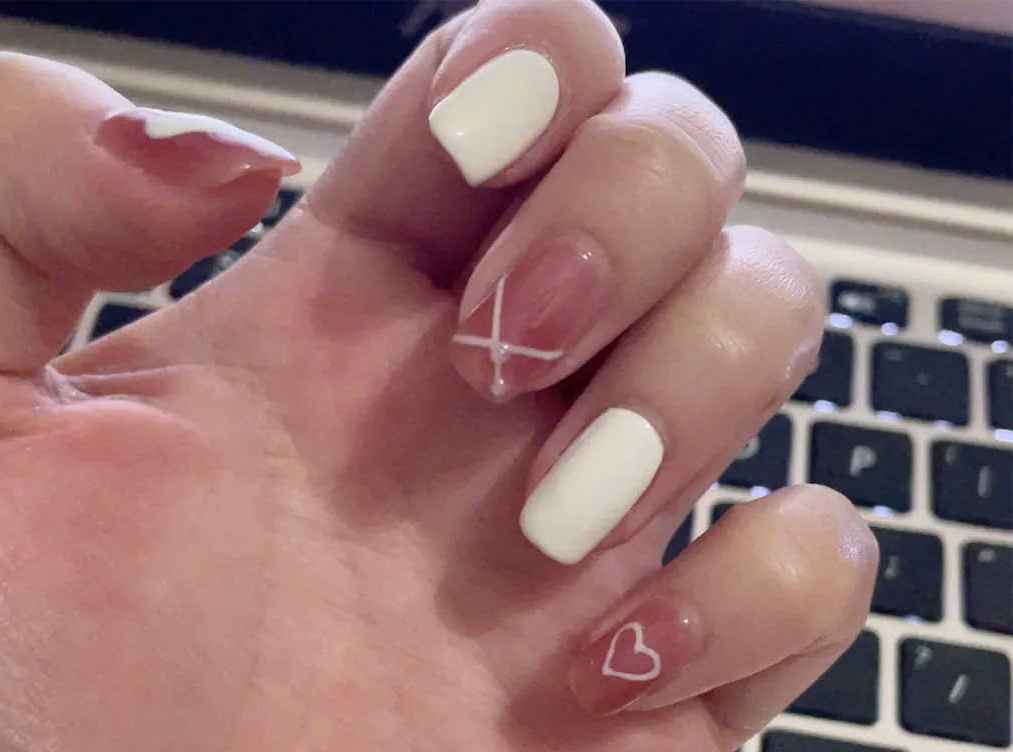 Thoa kem duong am hang ngay de mong nhanh phuc hoi hon. Anh: Mai Huong