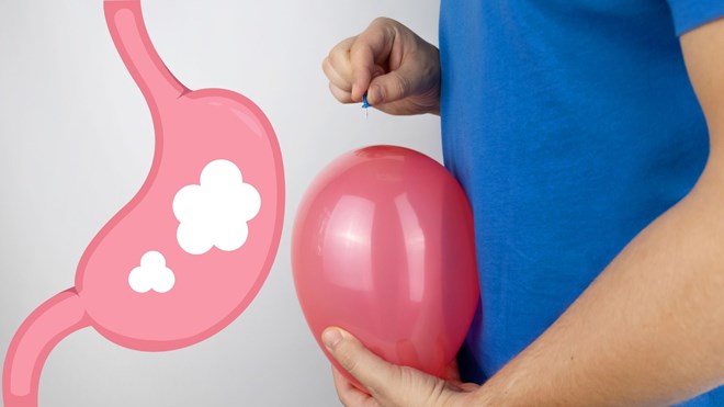 旅行は生活習慣と消化器系を混乱させやすい。写真:Dinh Dinh