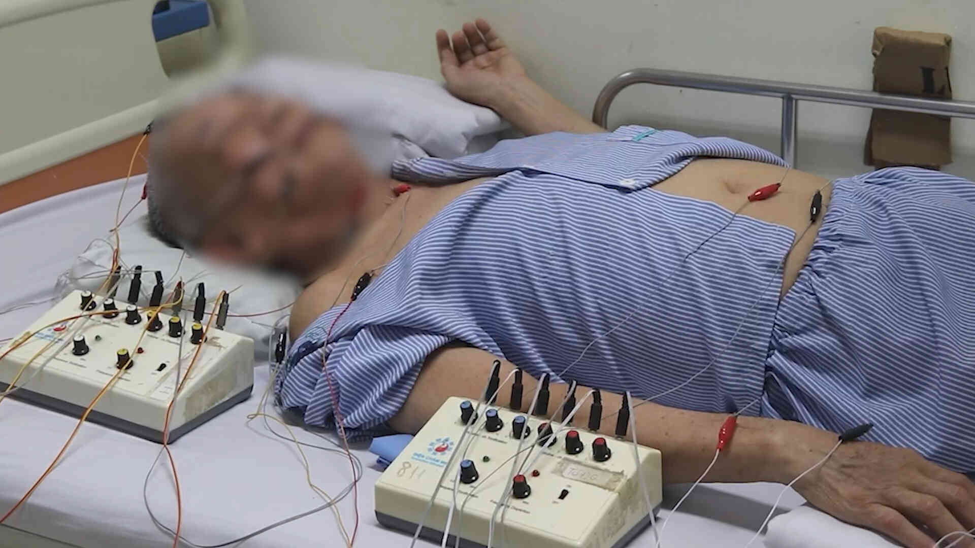 記憶障害を引き起こす脳卒中と知的障害のリスクに関する警告