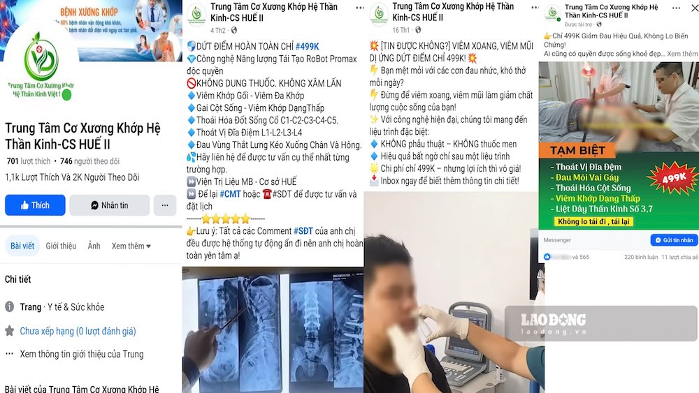 Fanpage “Trung tâm cơ xương khớp hệ thần kinh – CS Huế II” với những quảng cáo “trên trời” khiến nhiều người nhẹ dạ cả tin tìm đến chữa bệnh, rồi hối hận. Ảnh: PV