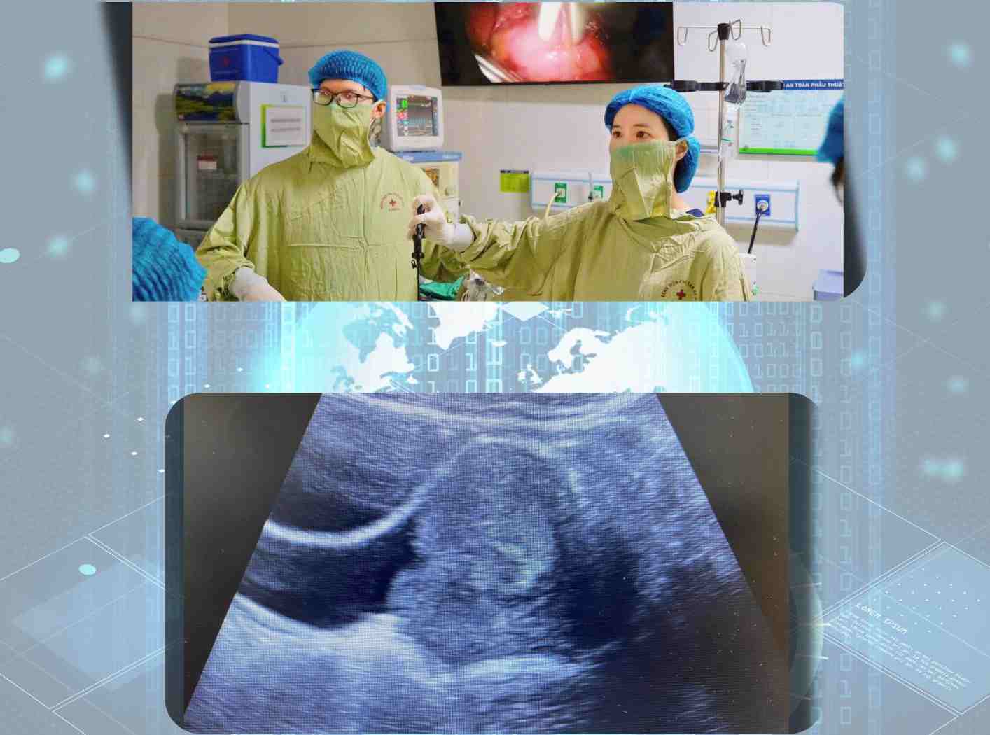 Hanoi Obstetrics and Gynecology Hospital handled a large vaginal polyp in a 19-year-old patient. Photo: BVCC