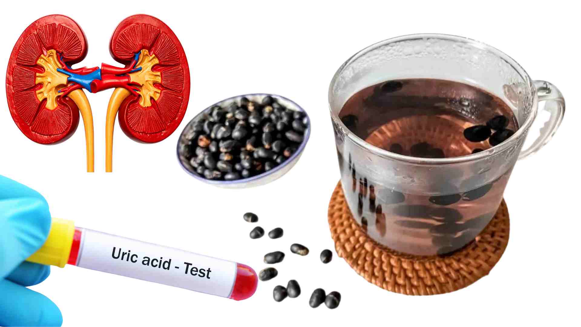 Be careful with high uric acid when drinking black bean water. Graphics: Ha May