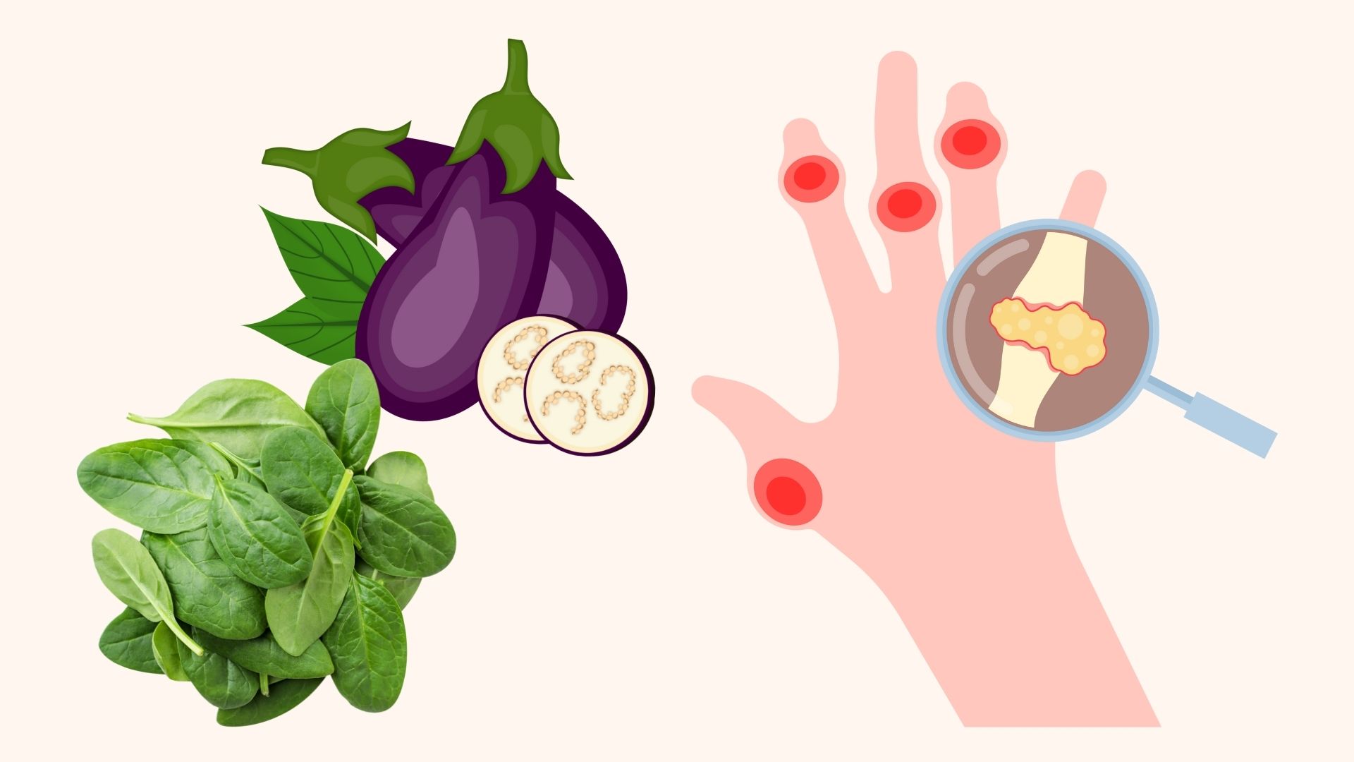 Vegetables that increase uric acid should be avoided during the rainy season. Graphics: Linh Dan