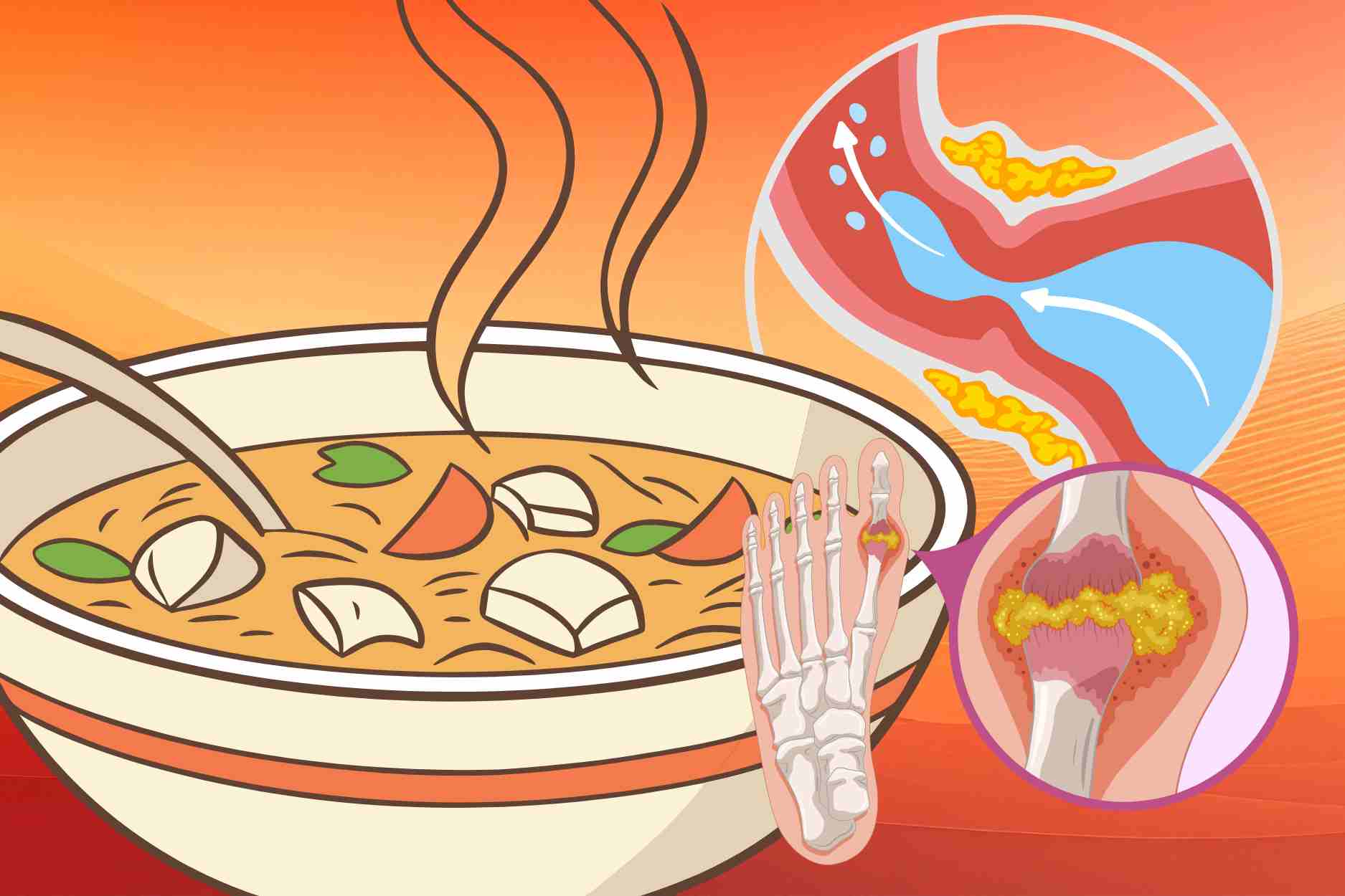 Cold-season soups help help eliminate uric acid, reduce arthritis
