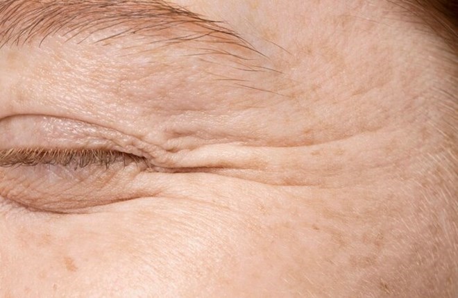 Cardiologists reveal three common misconceptions that cause many people to accidentally speed up the aging process. Photo: Thuy Duong