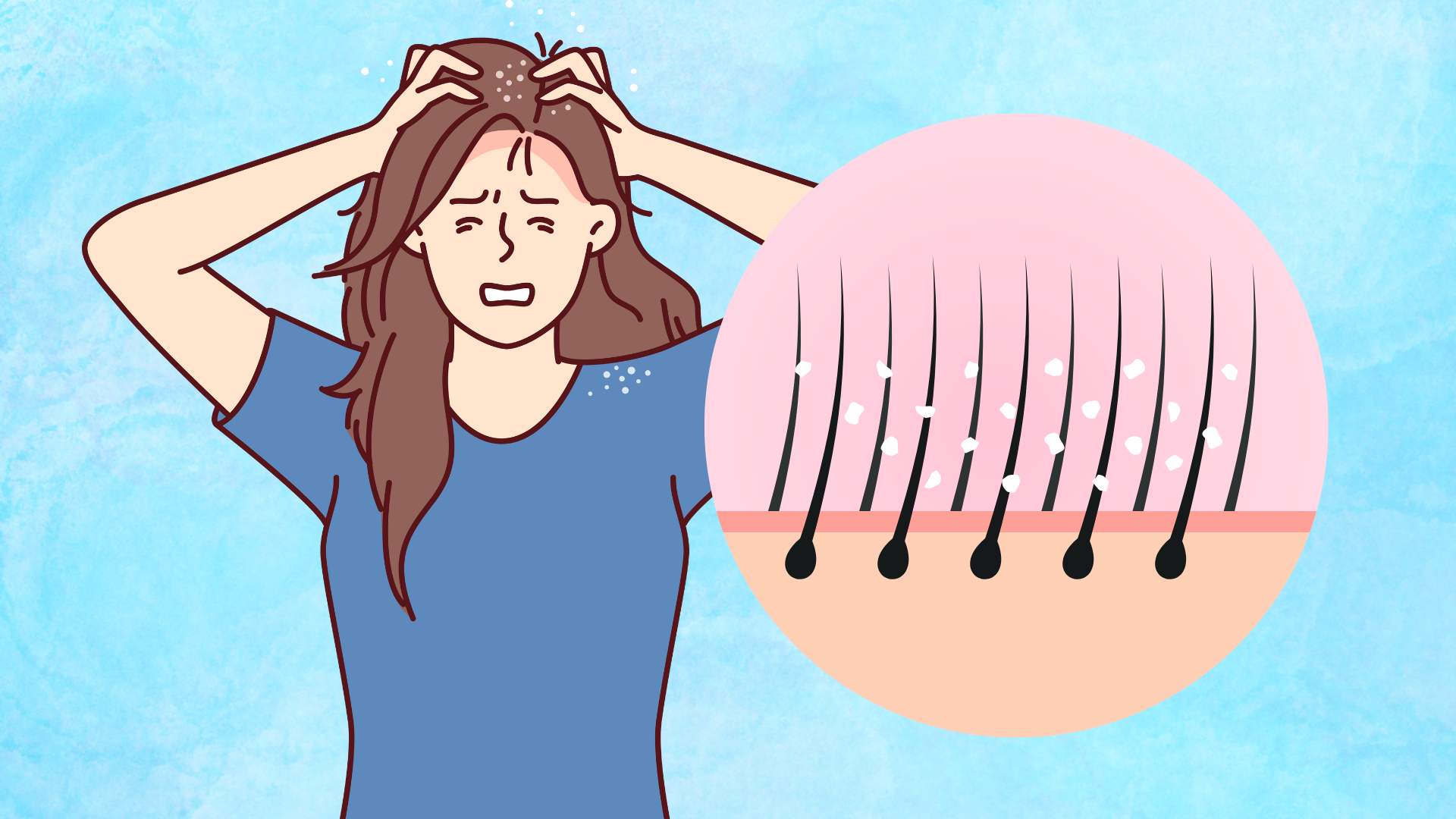 5 ways to keep hair dry in winter. Graphic photo: Hoang Loc