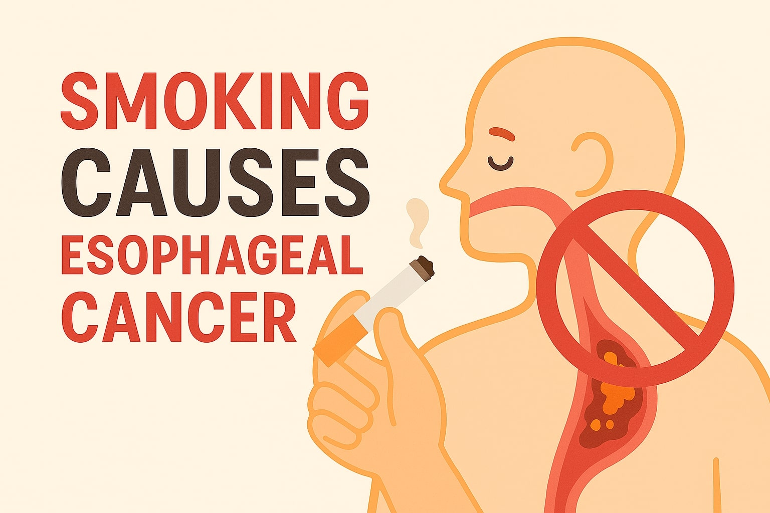 Esophageal tumor was discovered after a periodic check-up due to frequent smoking. Graphics: Huong Giang