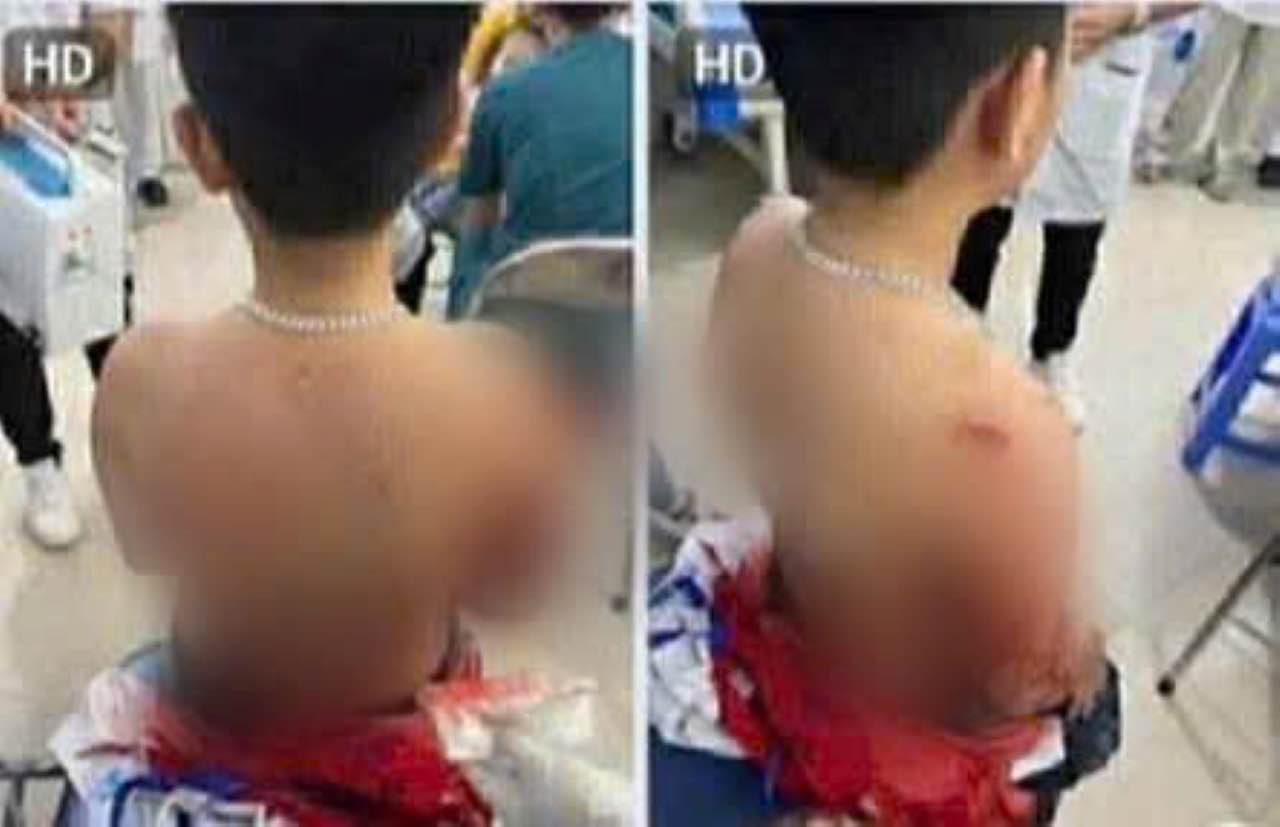 Suc khoe em Th hien da tam on dinh. Anh: Gia dinh cung cap