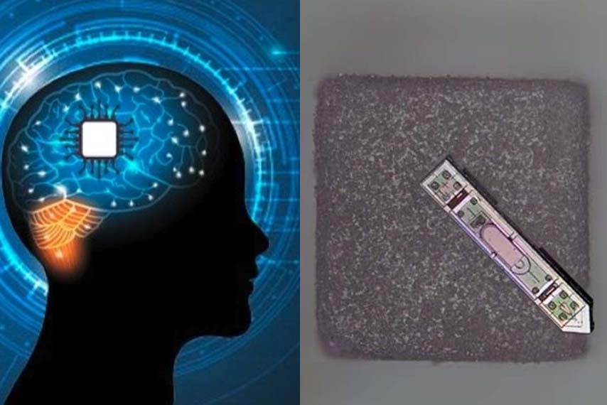 Scientists have developed micro brain transplant devices, opening up new prospects in neurological research and the application of precision medicine. Graphics: Cat Tien