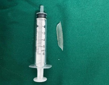 The foreign object was successfully removed. Photo: BVCC