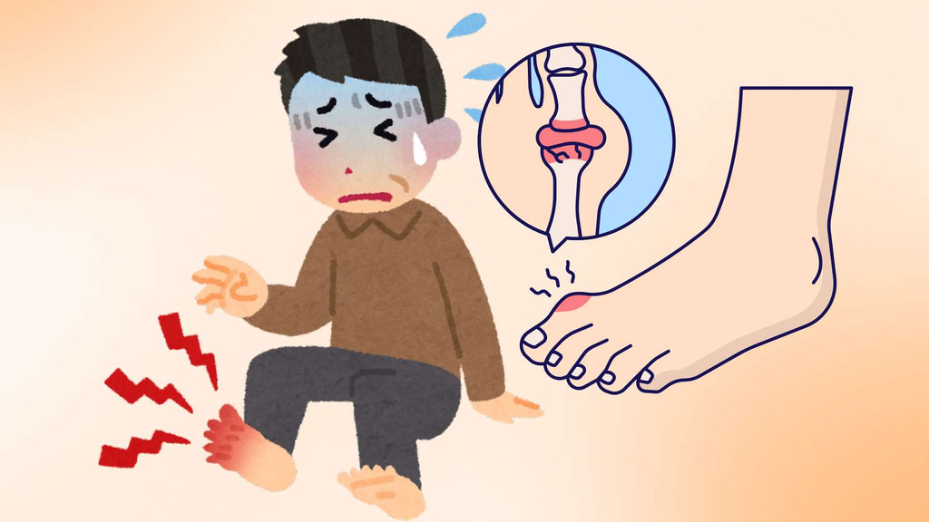 冬に尿酸値をコントロールするのに役立つ2つの重要な注意点