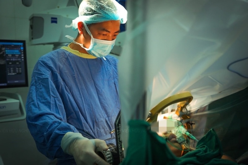 Doctors at Viet Duc Friendship Hospital use an organizational positioning framework in neurological and functional surgery such as parkinson, muscle astigmatism, inorganic shaking and atrophy surgery. Photo: BVCC