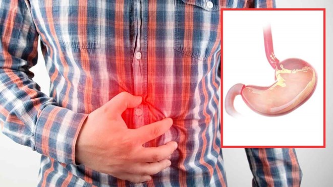 Regular acid reflux causes uncomfortable burning after eating, nutritionists share five foods that help soothe the stomach and support healthy digestion. Graphics: Ngoc Thuy