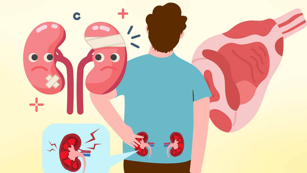 Tips on how to eat goat meat safely for people with weak kidneys