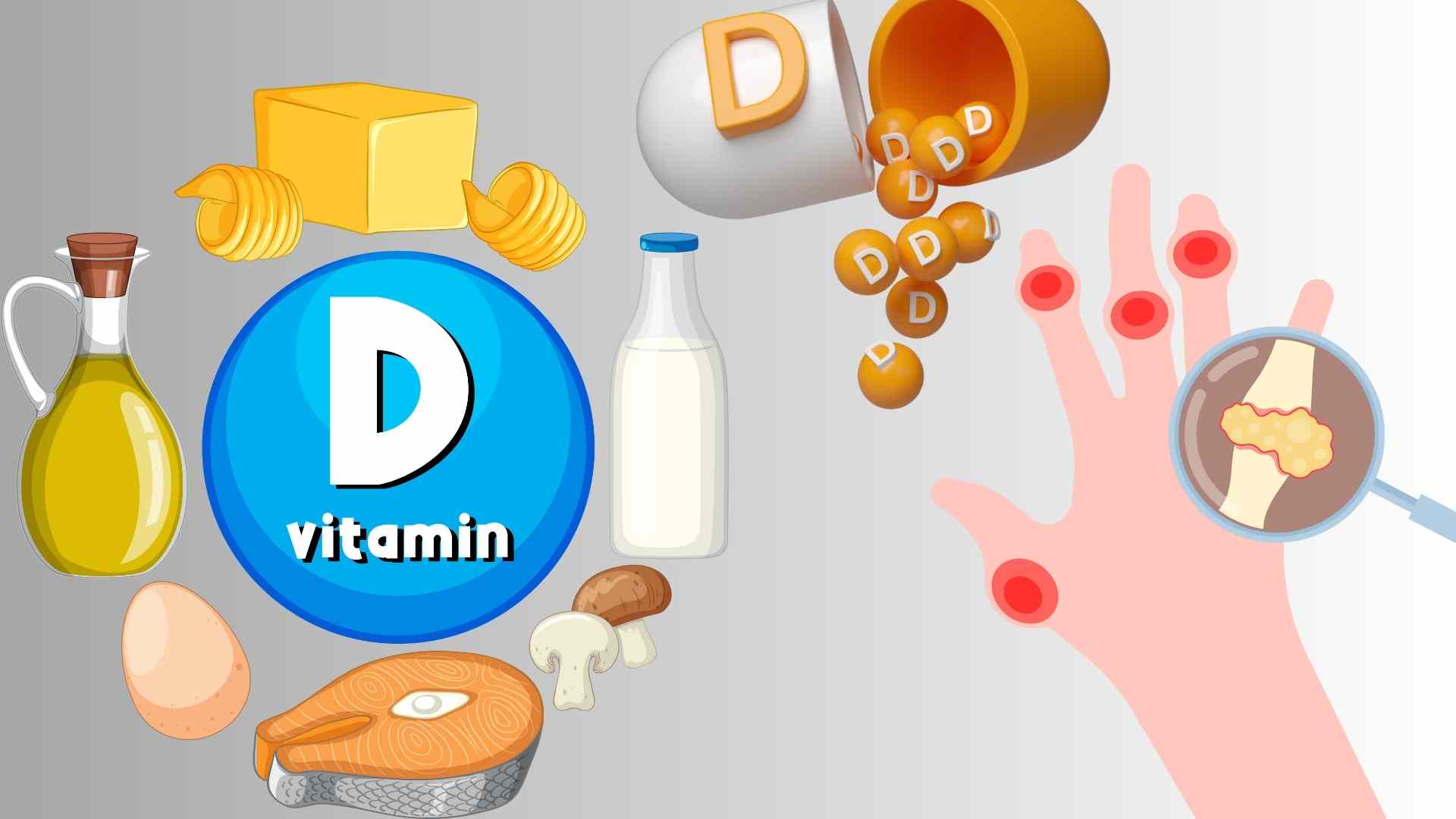 Supplementing vitamin D can help control uric acid. Graphics: Ha May