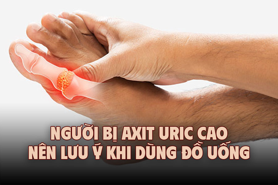 People with high uric acid should pay attention when drinking