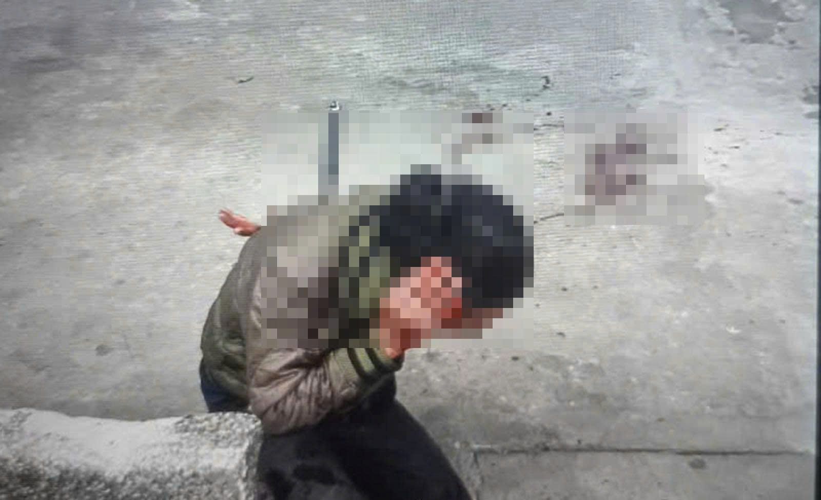 Nhân viên cây xăng tại Khánh Hòa bị đâm. Ảnh: Phương Linh