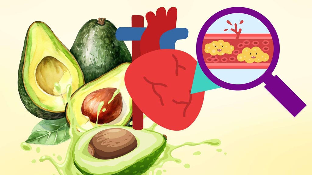 3 types of fruit that many people like but people with high blood fat should not eat much