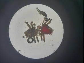 Itchy in the kinal area, the man discovered a parasitic muzzle. Photo: BVCC