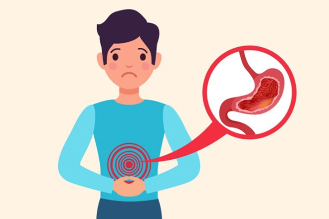 The seemingly harmless habit after meals is the cause of intestinal deterioration, but can be overcome with simple exercise. Photo: Hai Nguyen