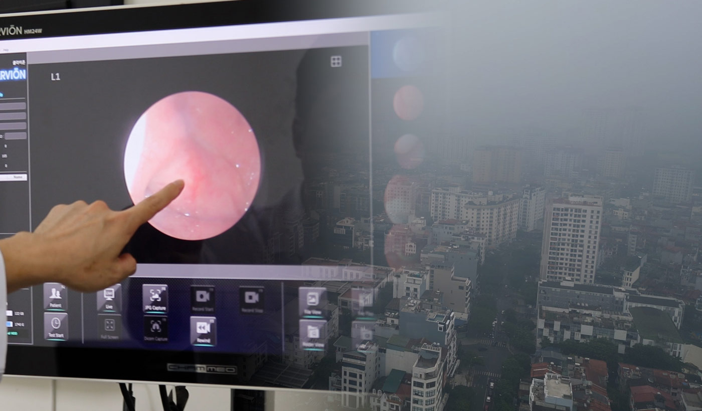 Doctors warn of a series of risks to the nose and throat